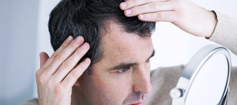 Perte des cheveux  comment faire pour lutter ? en octobre 2023